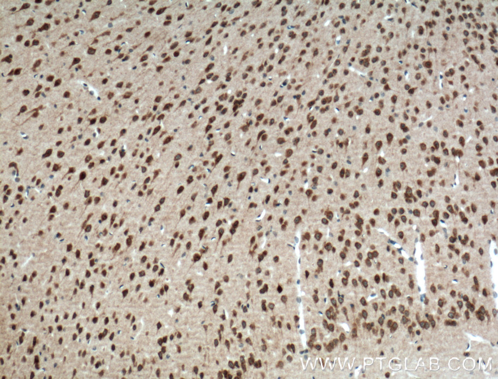 IHC staining of mouse brain using 12053-1-AP