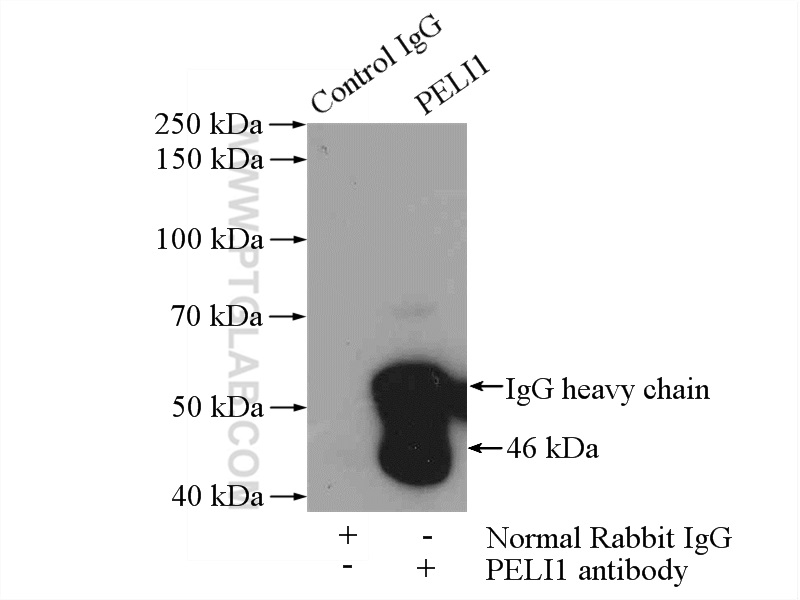 IP experiment of SH-SY5Y using 12053-1-AP