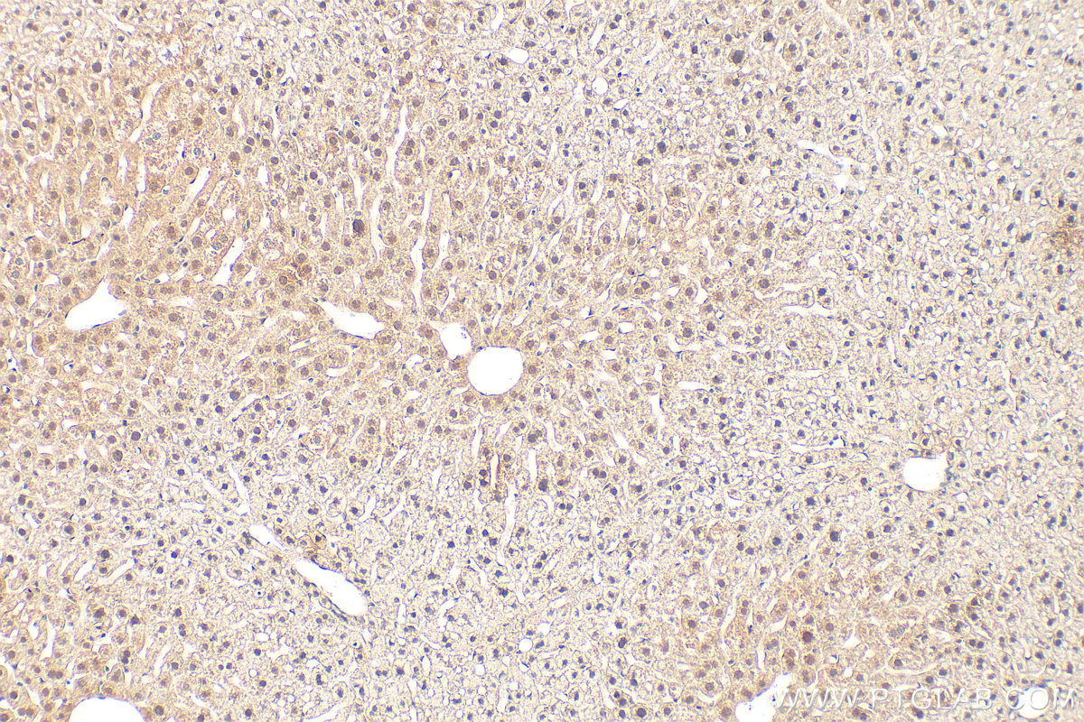 IHC staining of mouse liver using 87624-2-RR