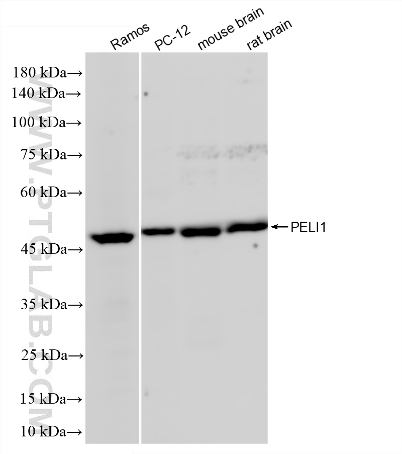 WB analysis using 87624-2-RR WB analysis using 87624-2-RR