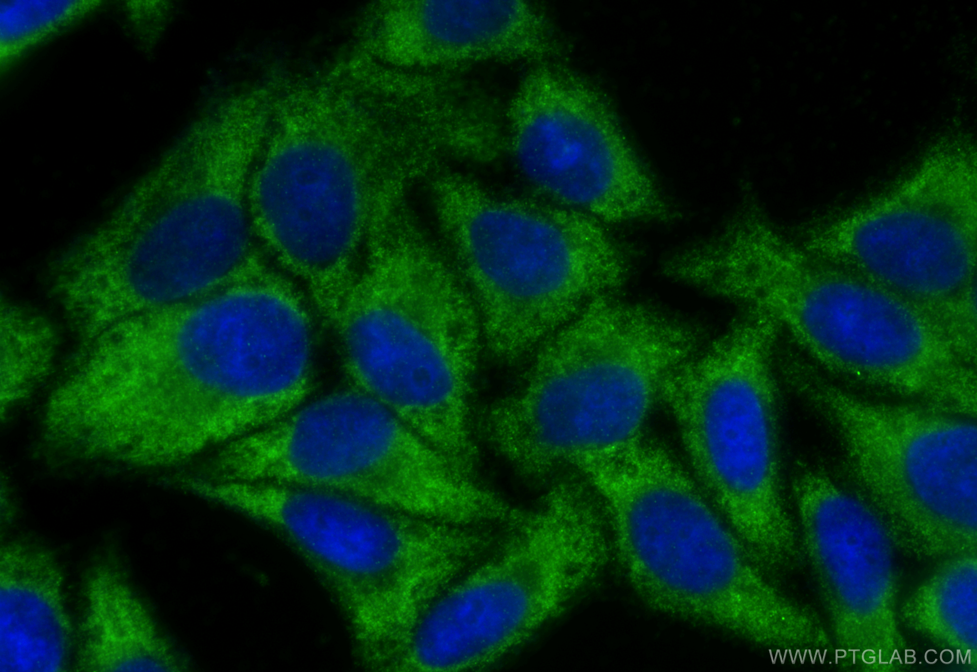 IF Staining of HepG2 using 16097-1-AP