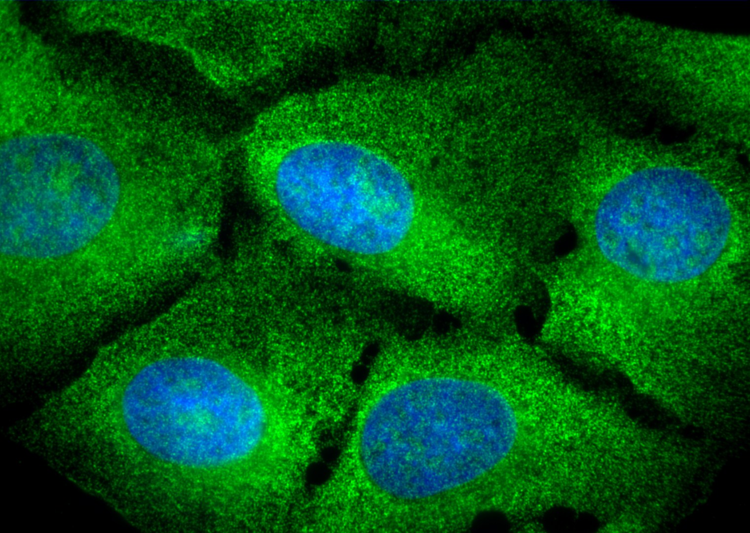 IF Staining of U2OS cells using 10582-1-AP