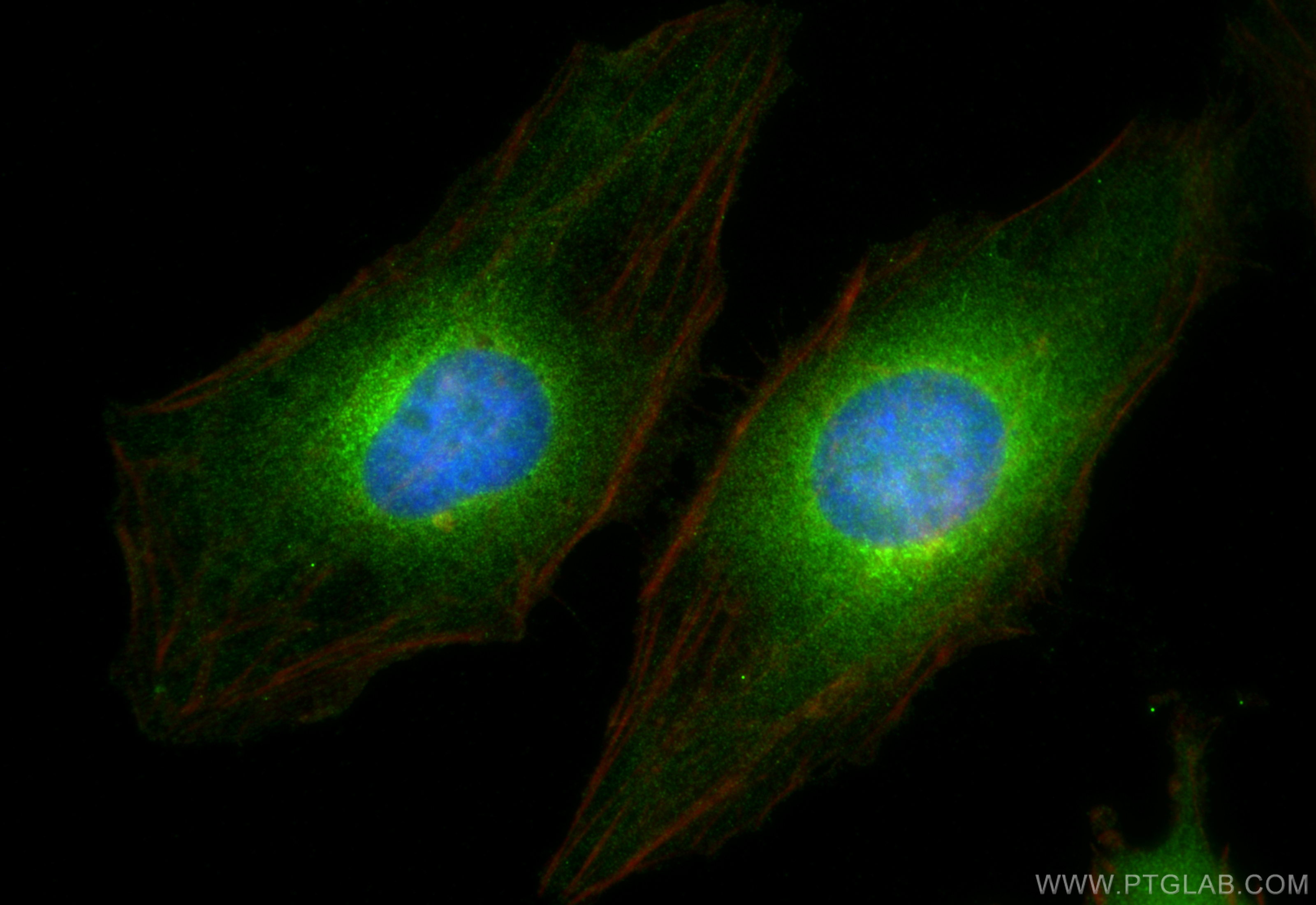 IF Staining of HeLa using 10582-1-AP