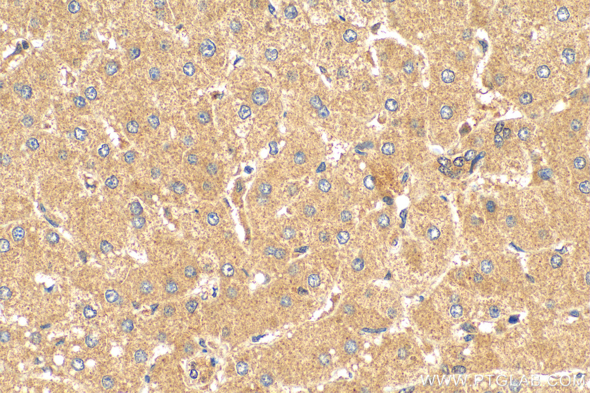 IHC staining of human liver using 10582-1-AP