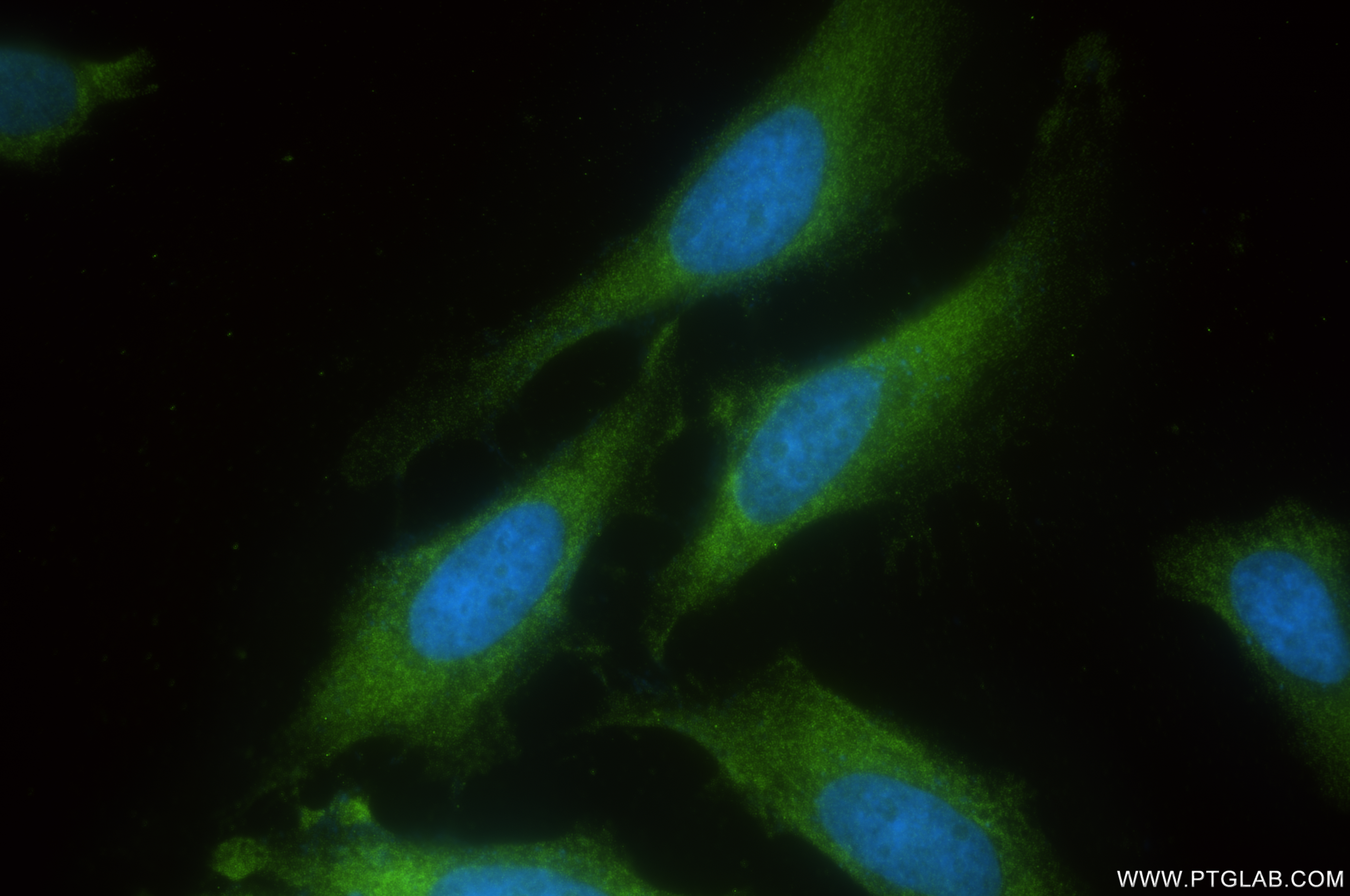 IF Staining of HeLa using 85743-1-RR