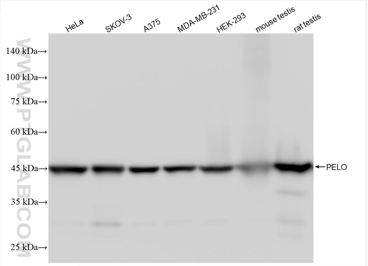 WB analysis using 85743-2-RR (same clone as 85743-2-PBS)