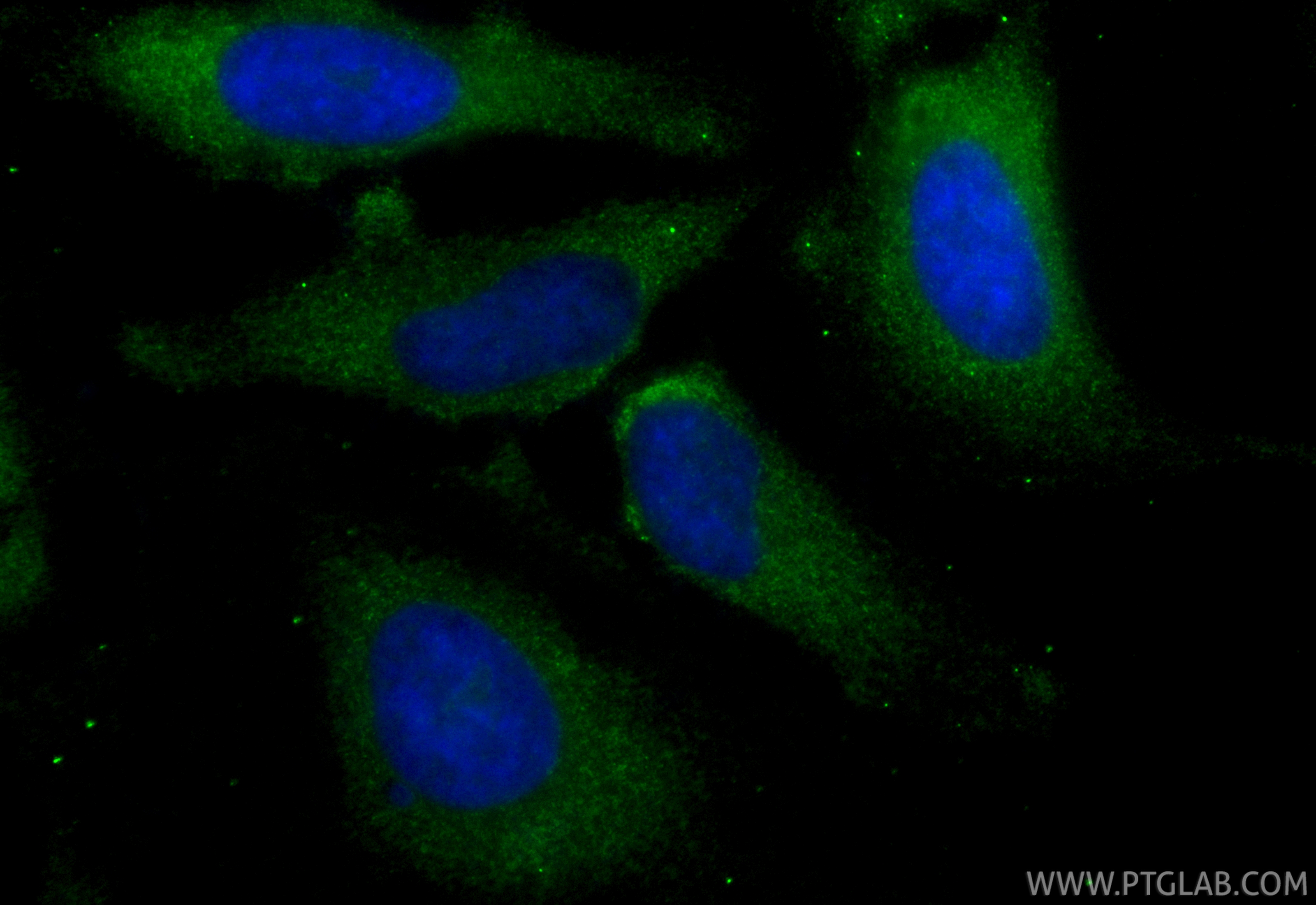 Immunofluorescent analysis of (-20°C Methanol) fixed HeLa cells using CoraLite® Plus 488 PELO antibody (CL488-85743, Clone: 243137F4 ) at dilution of 1:200. IF Staining of HeLa using CL488-85743