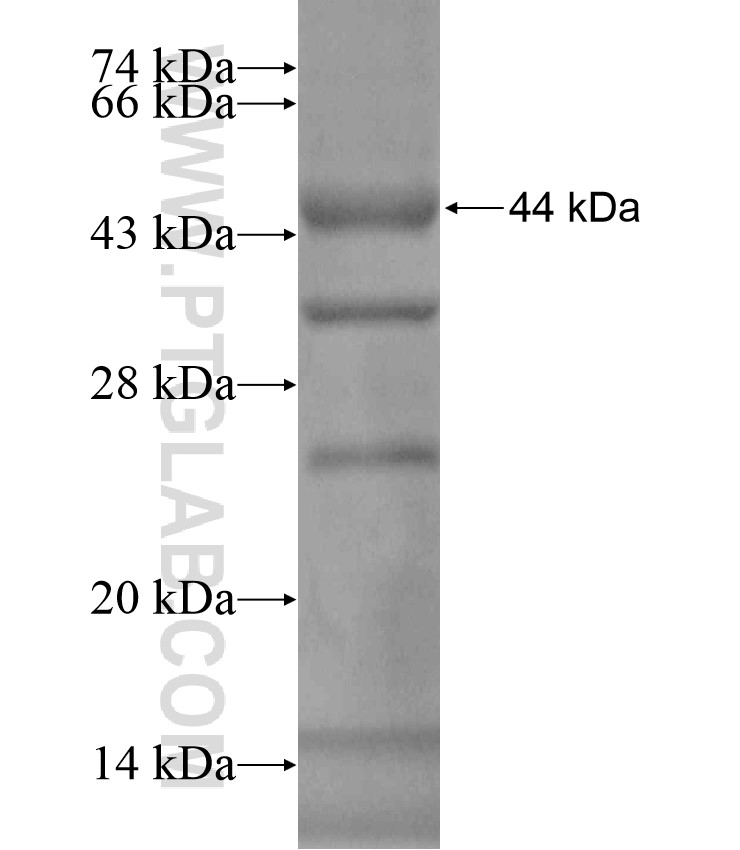 PELP1 fusion protein Ag18087 SDS-PAGE PELP1 fusion protein Ag18087 SDS-PAGE