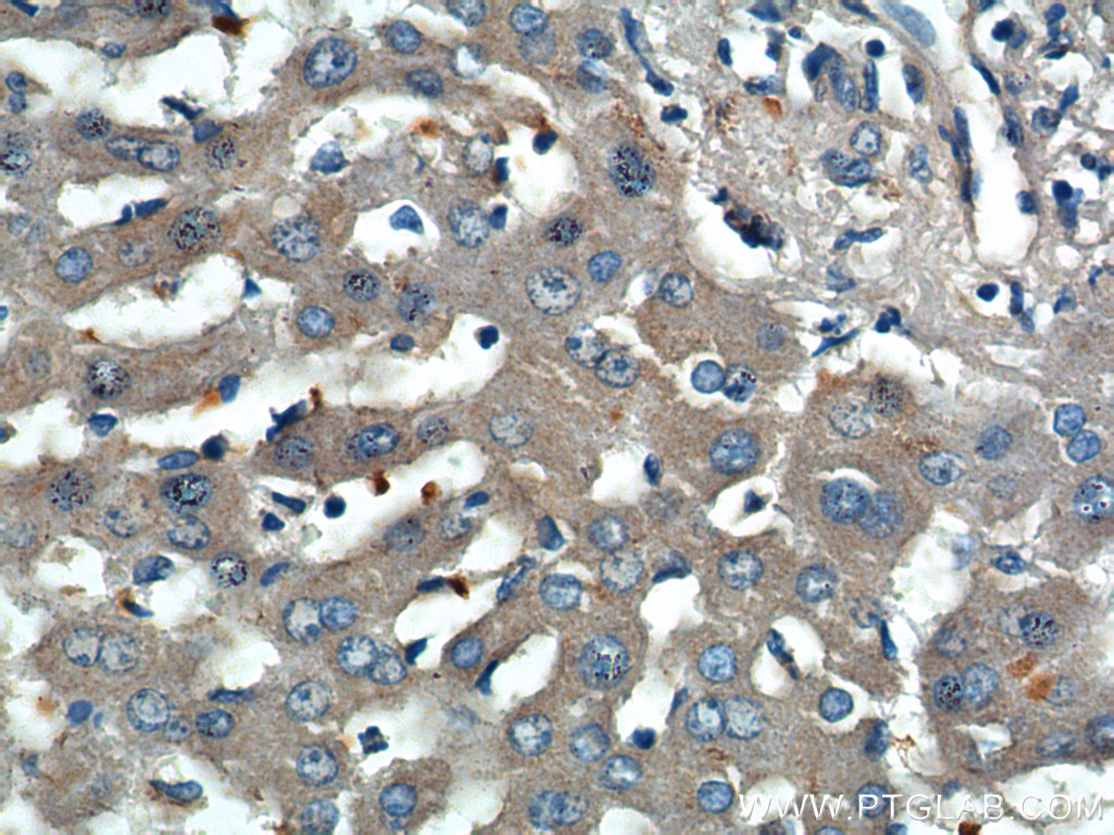 IHC staining of human liver using 25916-1-AP