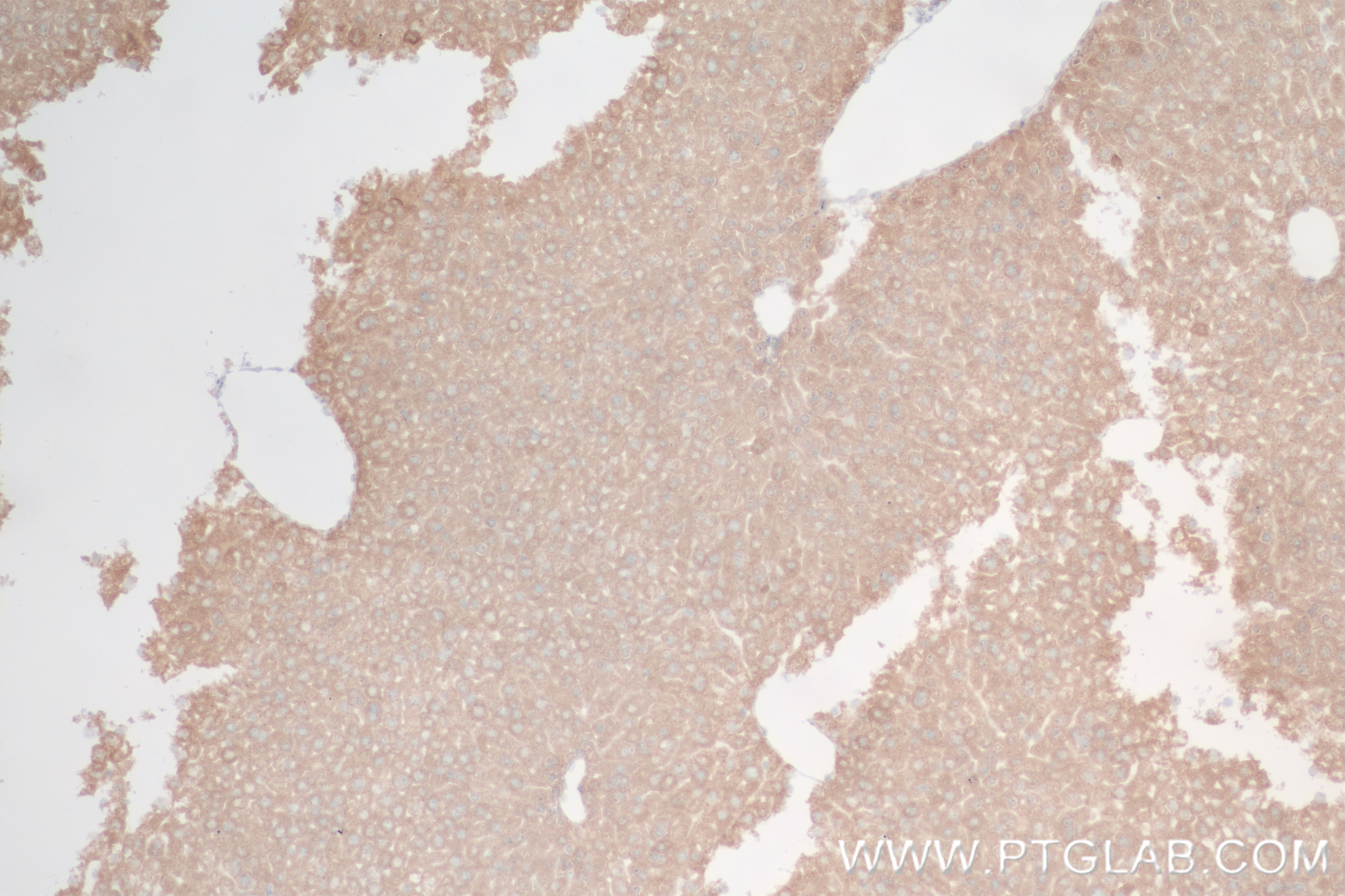 IHC staining of mouse liver using 85099-1-RR