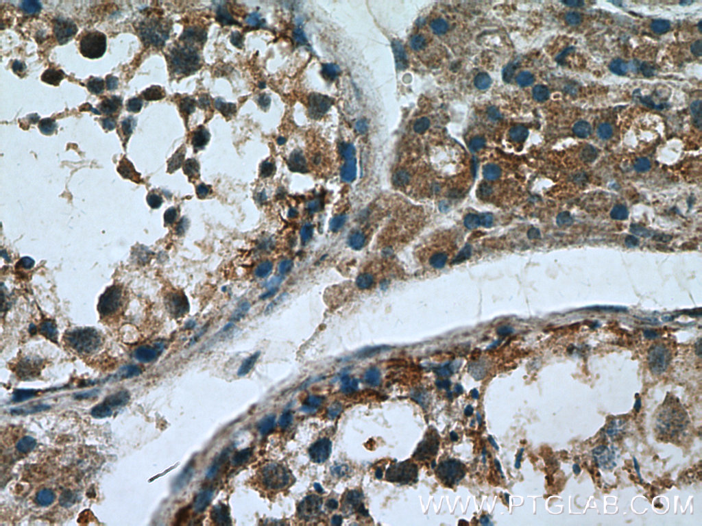 IHC staining of human testis using 13531-1-AP