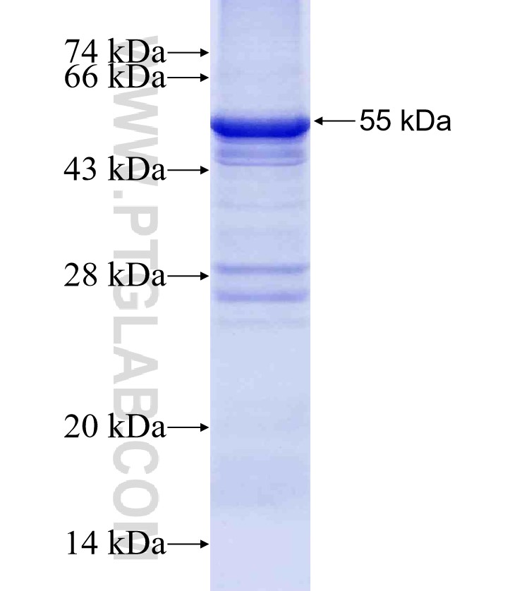 PENK fusion protein Ag4428 SDS-PAGE
