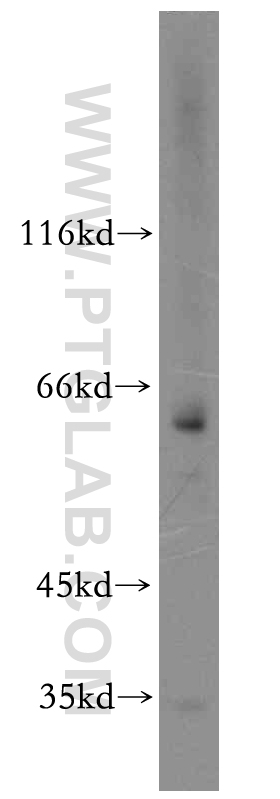 WB analysis of HeLa using 13435-1-AP