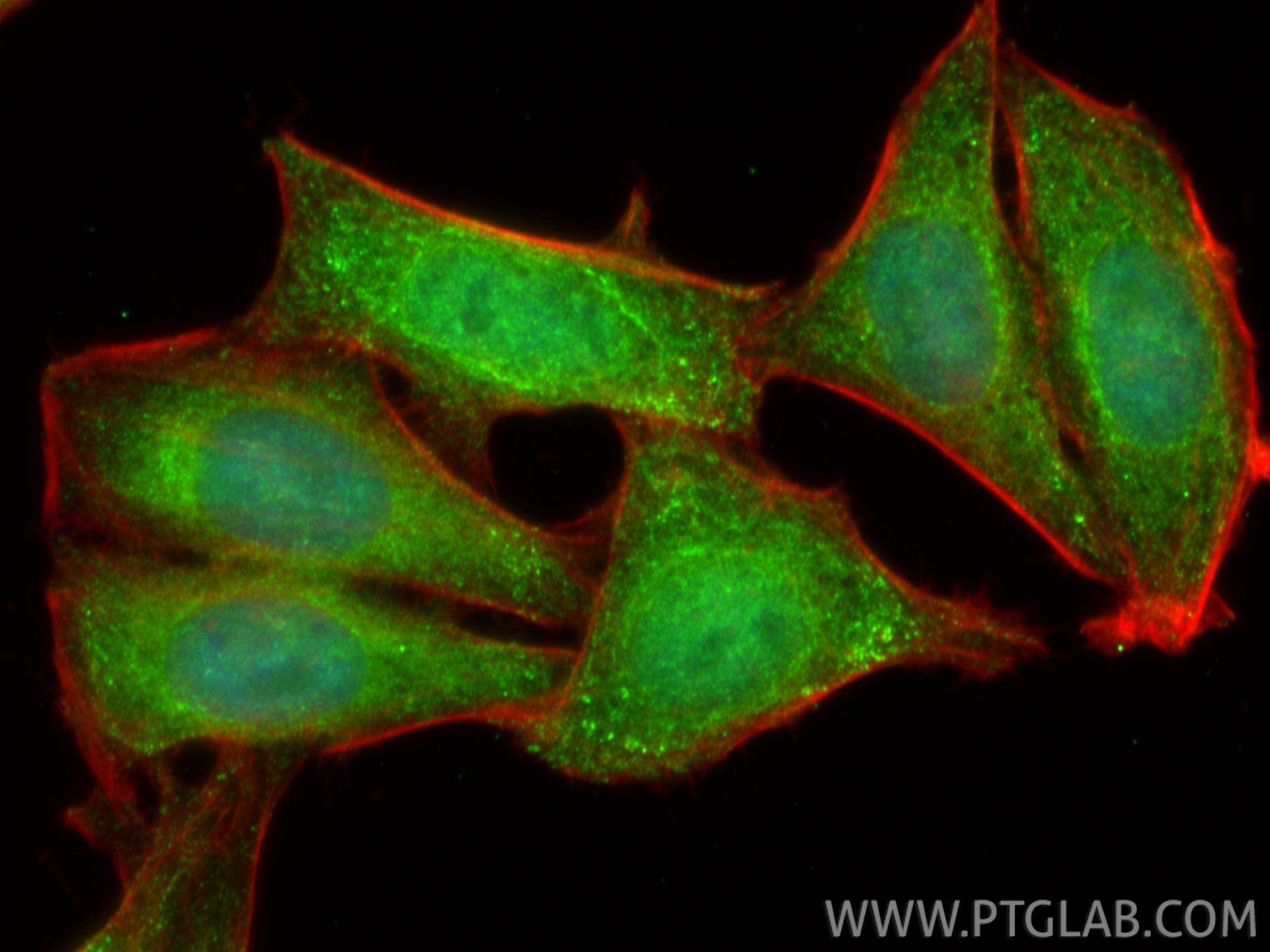 IF Staining of HepG2 using 13463-1-AP IF Staining of HepG2 using 13463-1-AP