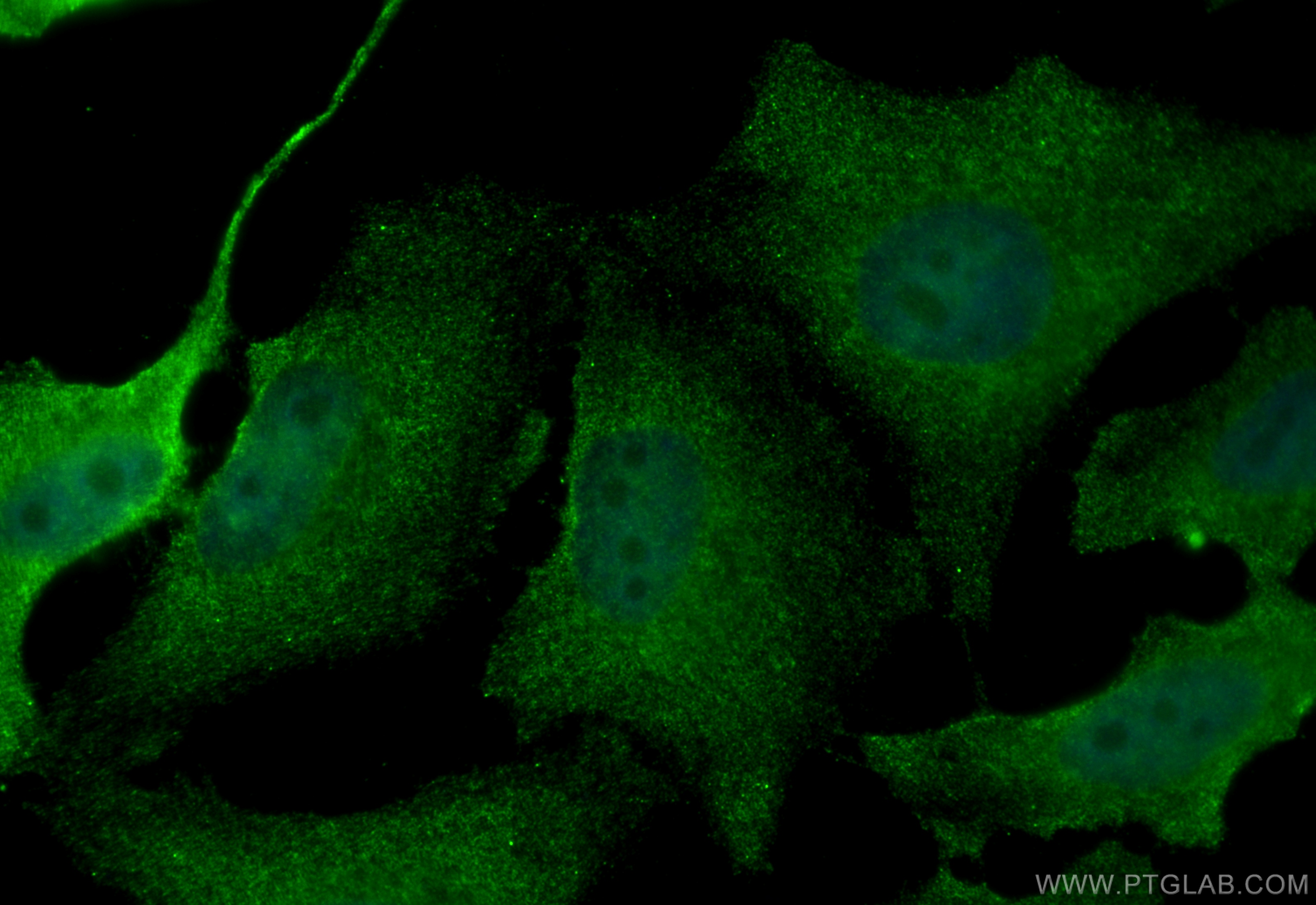 IF Staining of HeLa using 67513-1-Ig