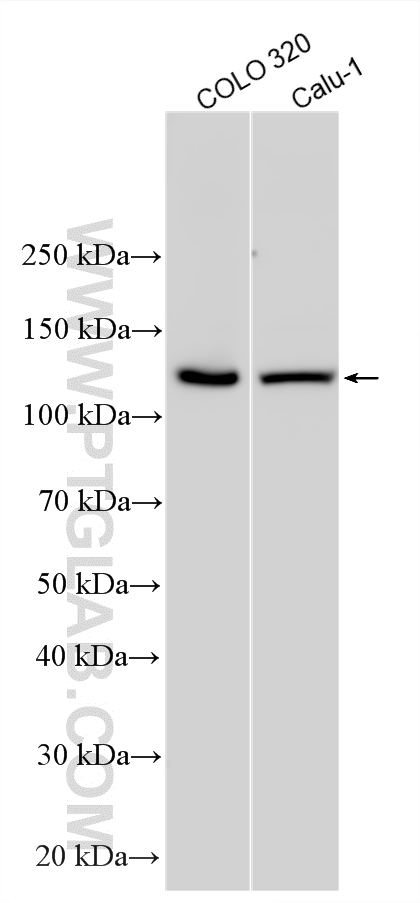 Various lysates were subjected to SDS PAGE followed by western blot with 12550-1-AP (PER3 antibody) at dilution of 1:4000 incubated at room temperature for 1.5 hours. WB analysis using 12550-1-AP