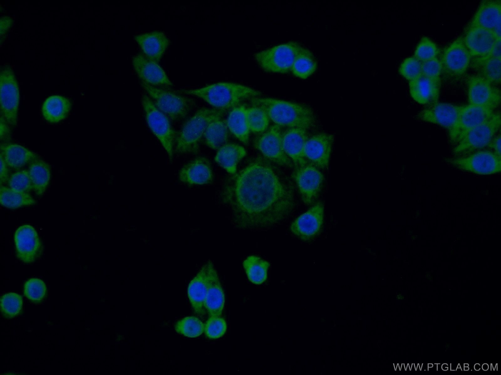 IF Staining of HeLa using 20582-1-AP
