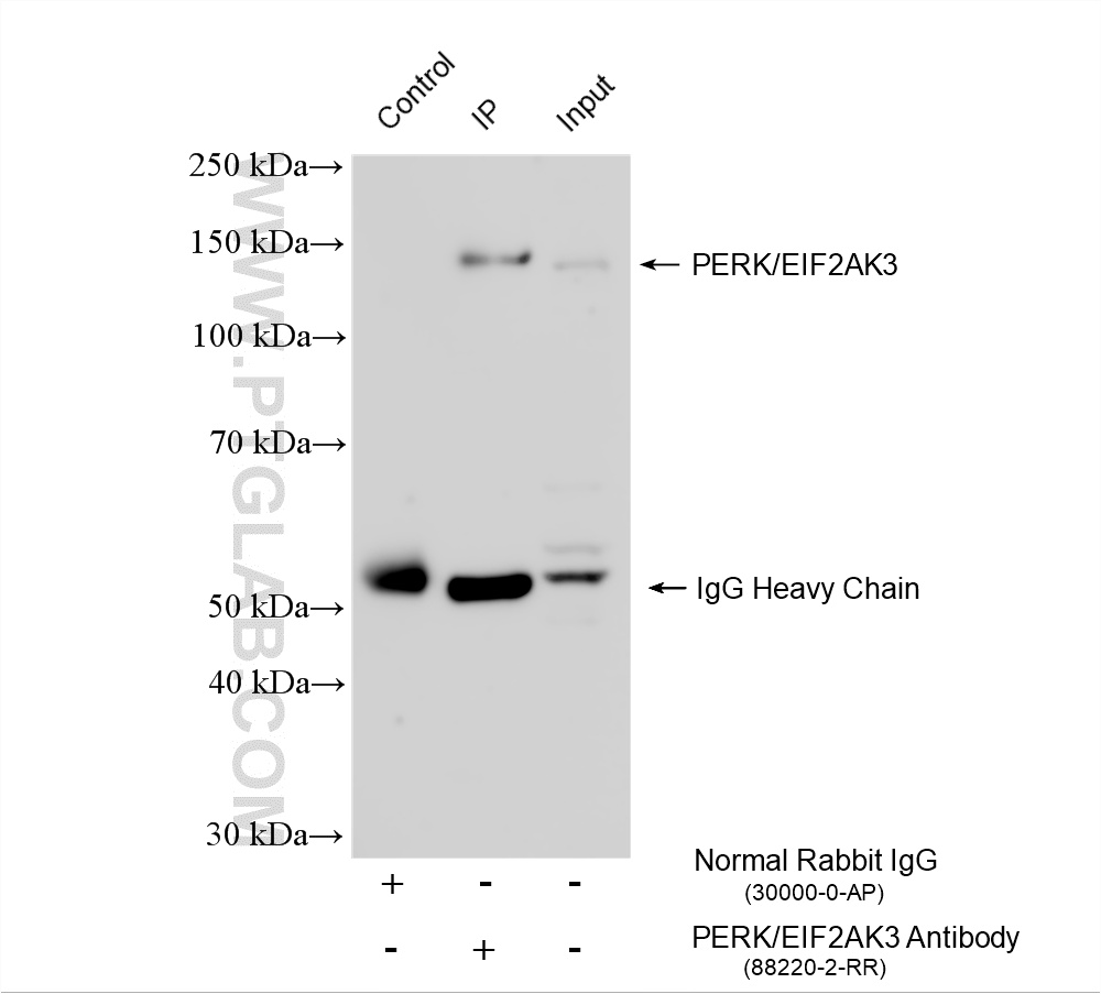 IP experiment of HeLa using 88220-2-RR (same clone as 88220-2-PBS) IP experiment of HeLa using 88220-2-RR (same clone as 88220-2-PBS)