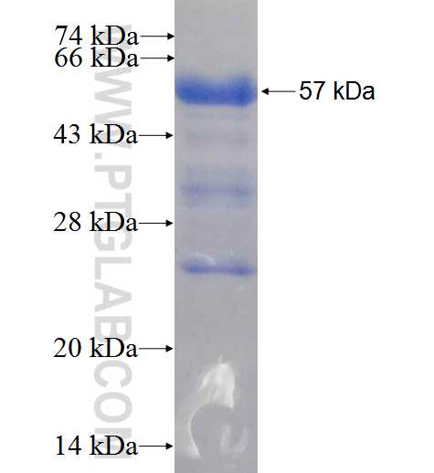 PES1 fusion protein Ag5159 SDS-PAGE PES1 fusion protein Ag5159 SDS-PAGE
