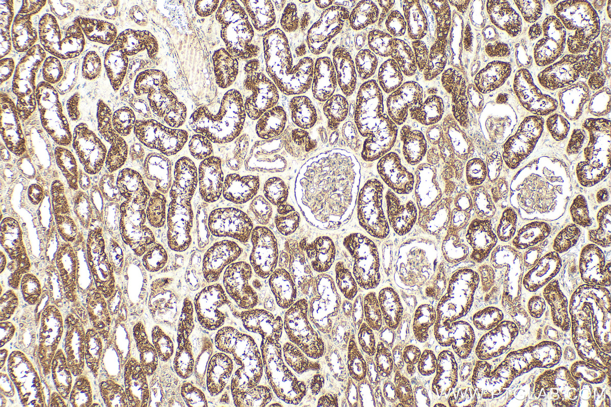 IHC staining of human kidney using 31066-1-AP