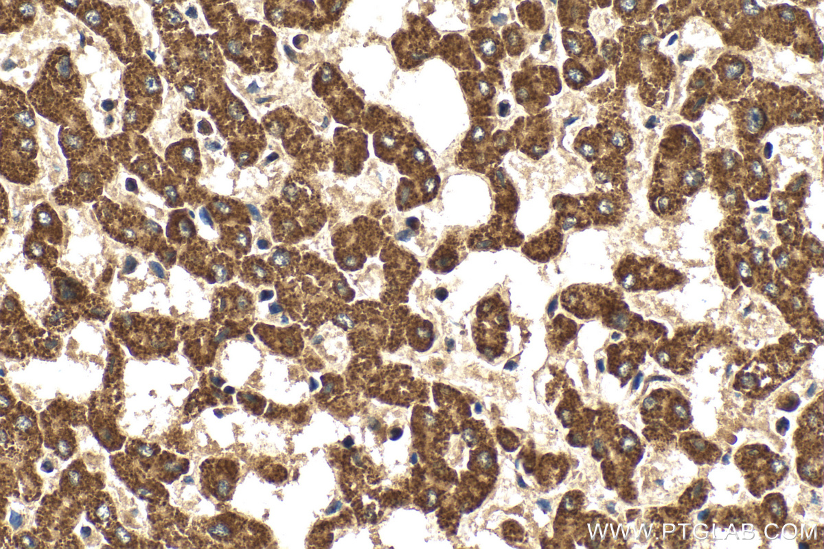 IHC staining of human liver using 31066-1-AP