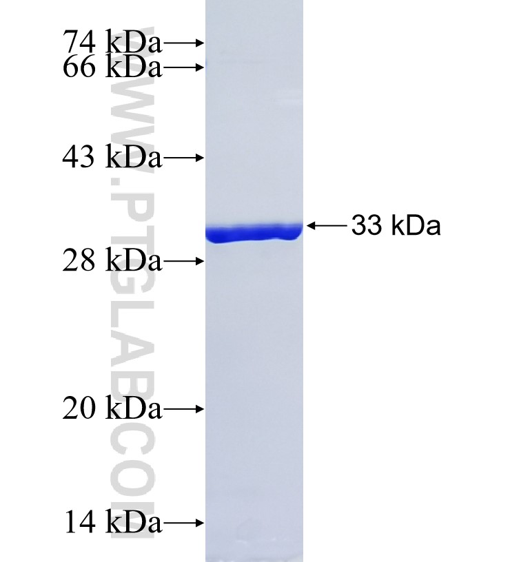 PET117 fusion protein Ag34525 SDS-PAGE