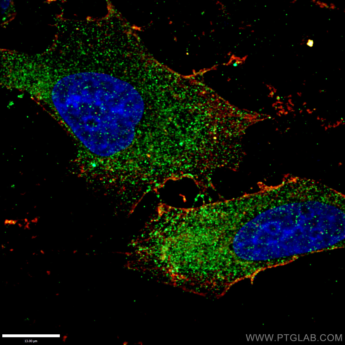 IF Staining of HepG2 using 13669-1-AP