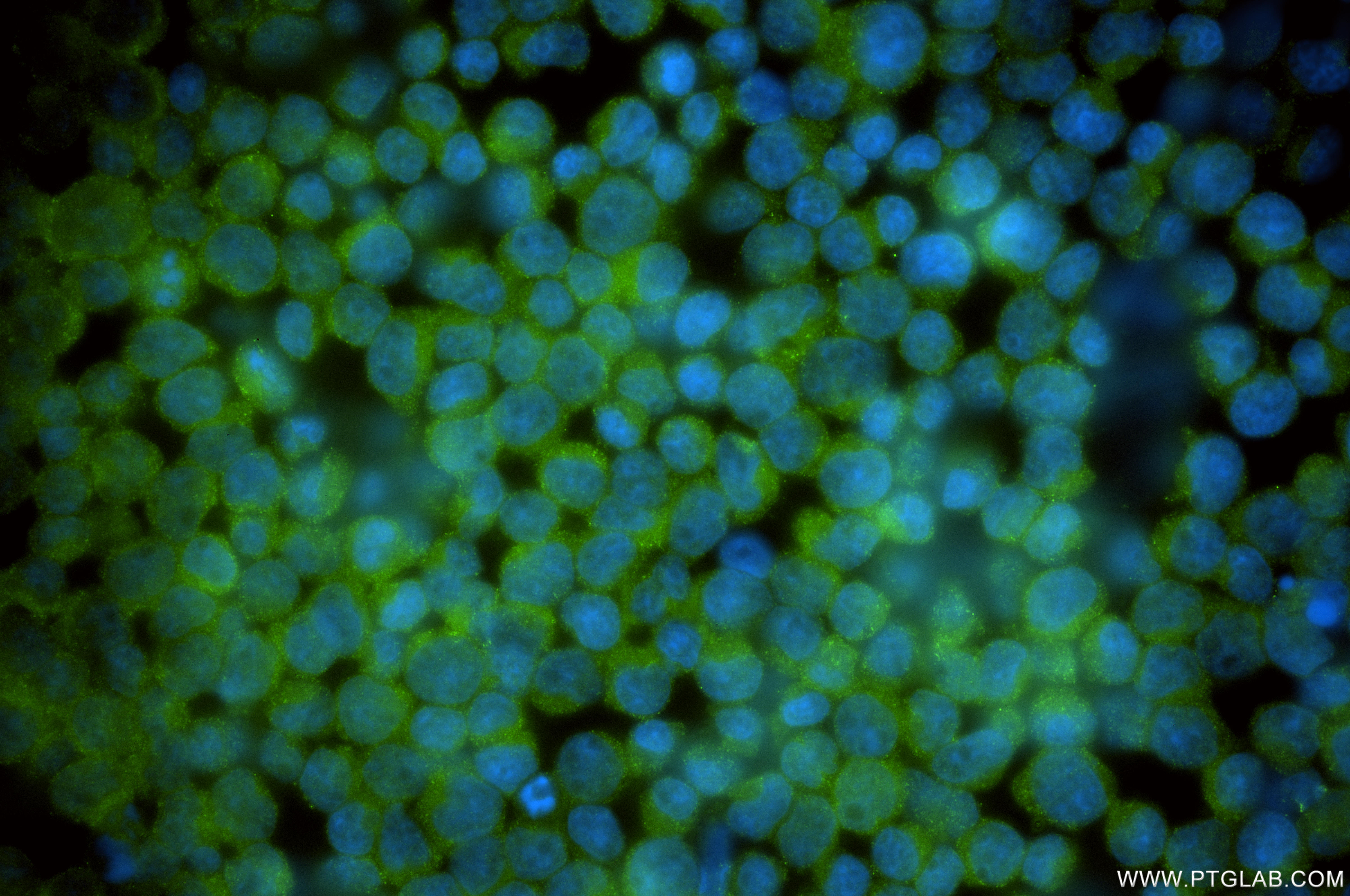Immunofluorescent analysis of (4% PFA) fixed Jurkat cells using PEX1 antibody (85429-4-RR, Clone: 242994F11 ) at dilution of 1:400 and Multi-rAb CoraLite ® Plus 488-Goat Anti-Rabbit Recombinant Secondary Antibody (H+L) (RGAR002). IF Staining of Jurkat using 85429-4-RR
