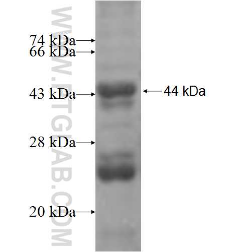 PEX1 fusion protein Ag5160 SDS-PAGE PEX1 fusion protein Ag5160 SDS-PAGE