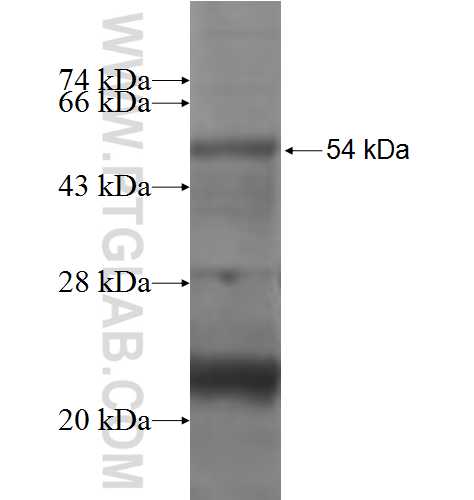 PEX11A fusion protein Ag2740 SDS-PAGE PEX11A fusion protein Ag2740 SDS-PAGE