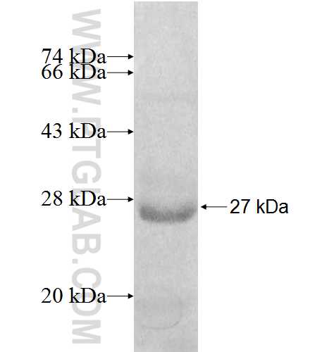 PEX11G fusion protein Ag8201 SDS-PAGE PEX11G fusion protein Ag8201 SDS-PAGE