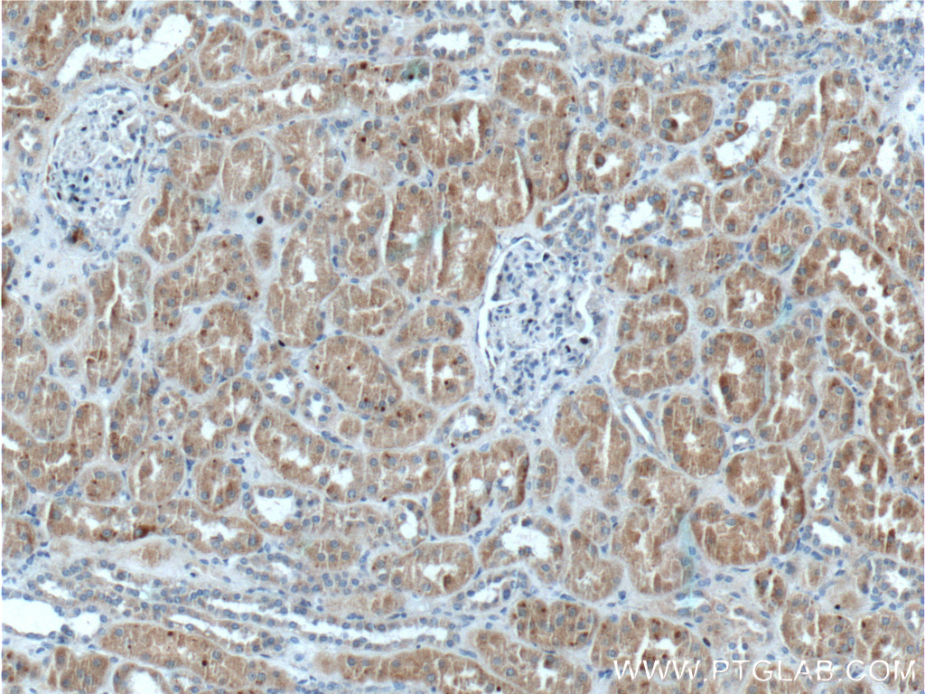 IHC staining of human kidney using 26649-1-AP