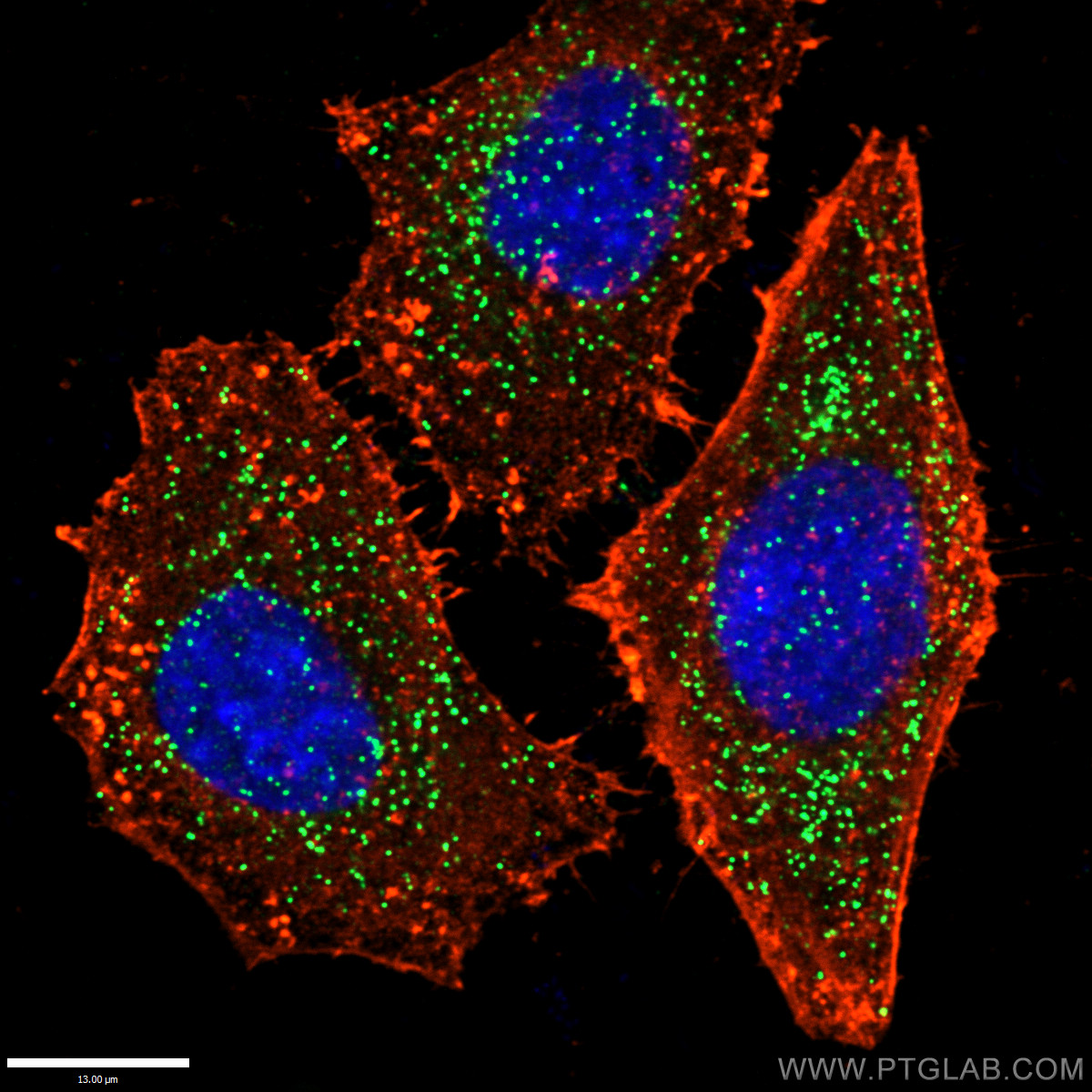 PEX14 Polyclonal antibody