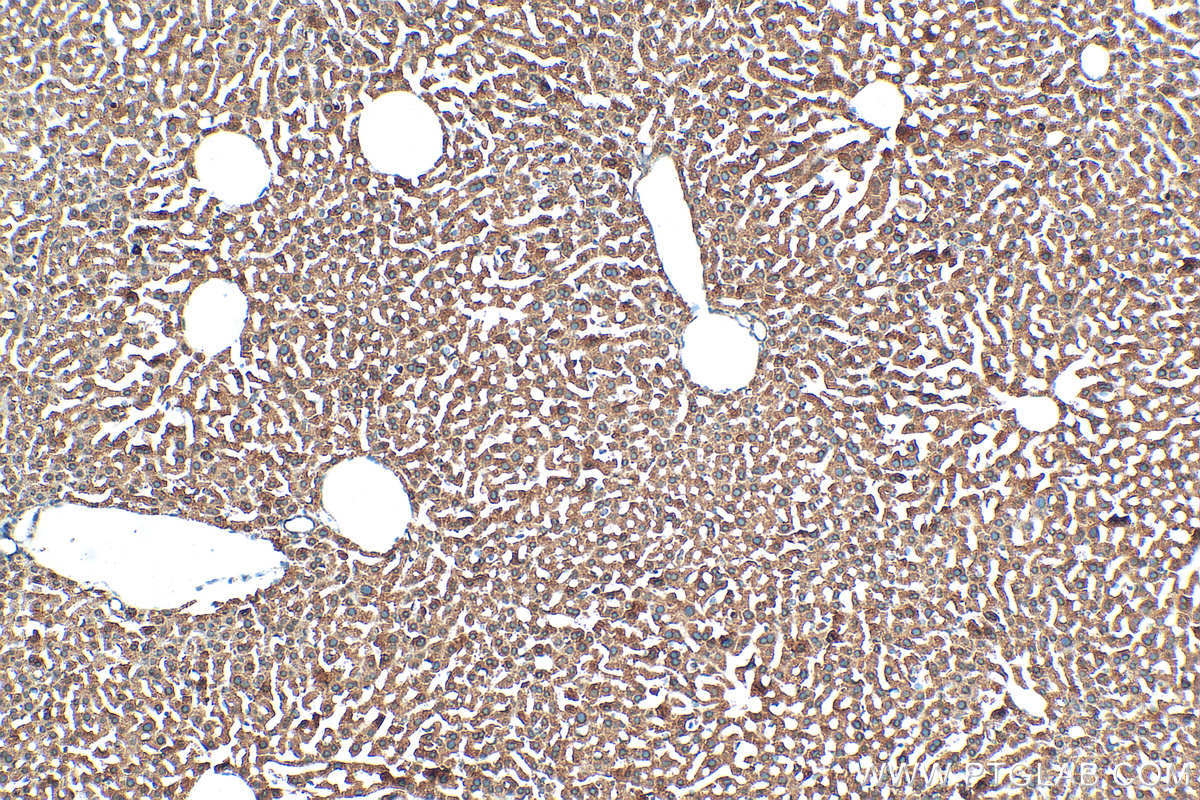 IHC staining of mouse liver using 10594-1-AP