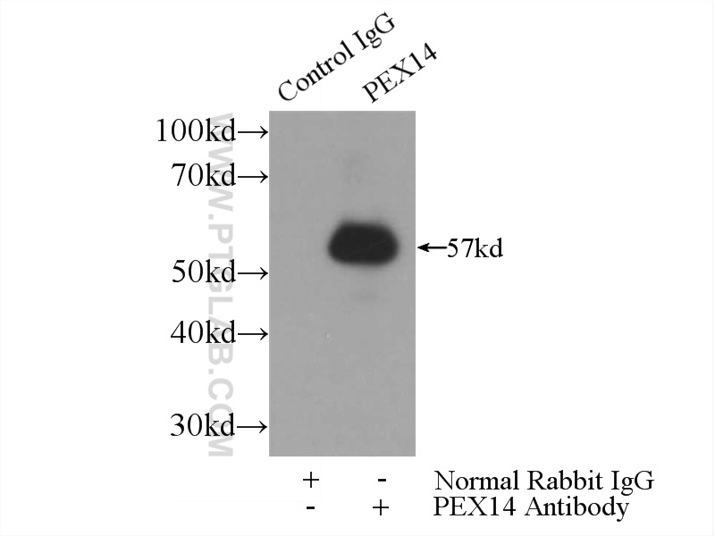 IP experiment of mouse liver using 10594-1-AP