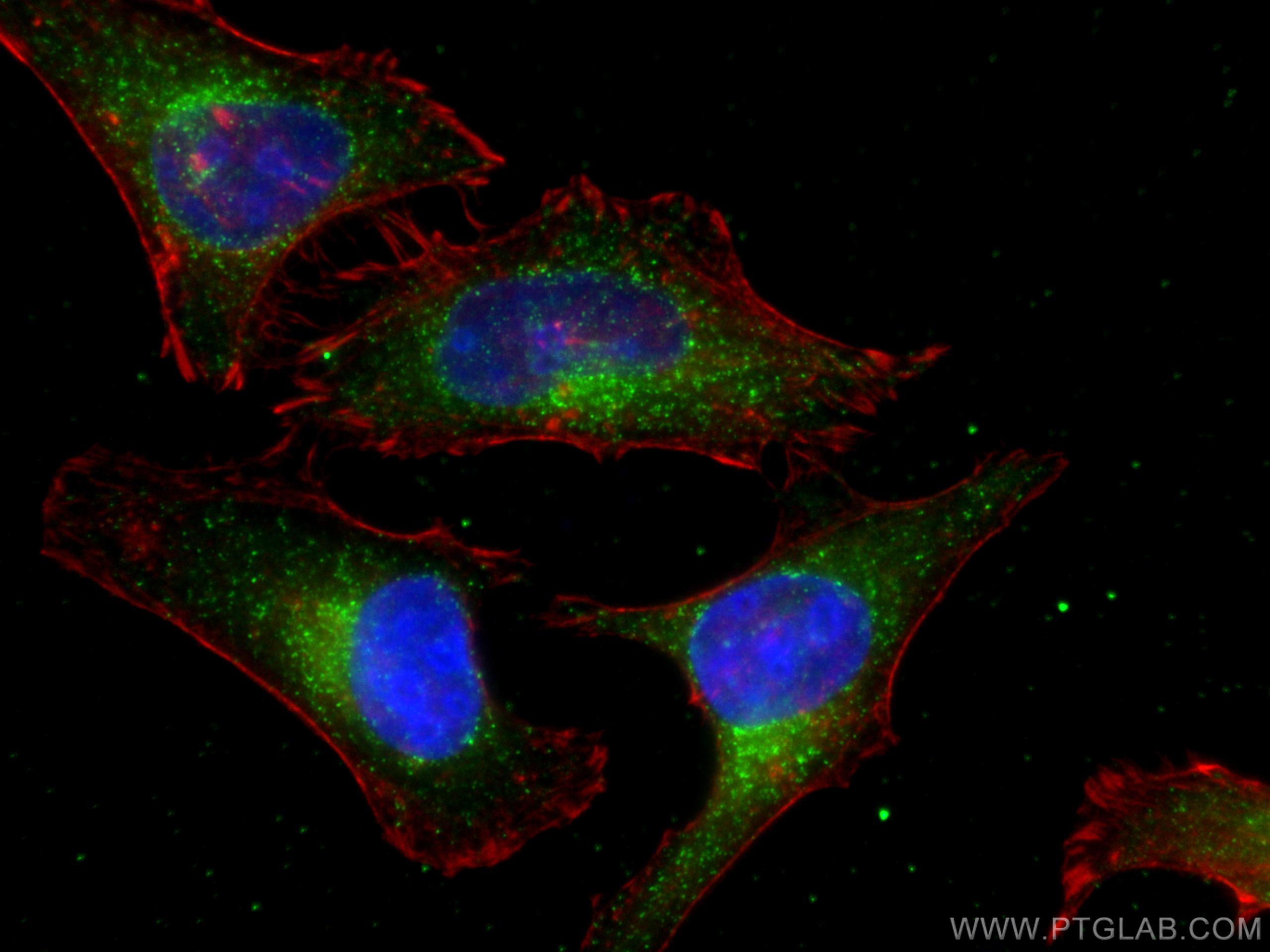 IF Staining of HeLa using 80234-1-RR (same clone as 80234-1-PBS)