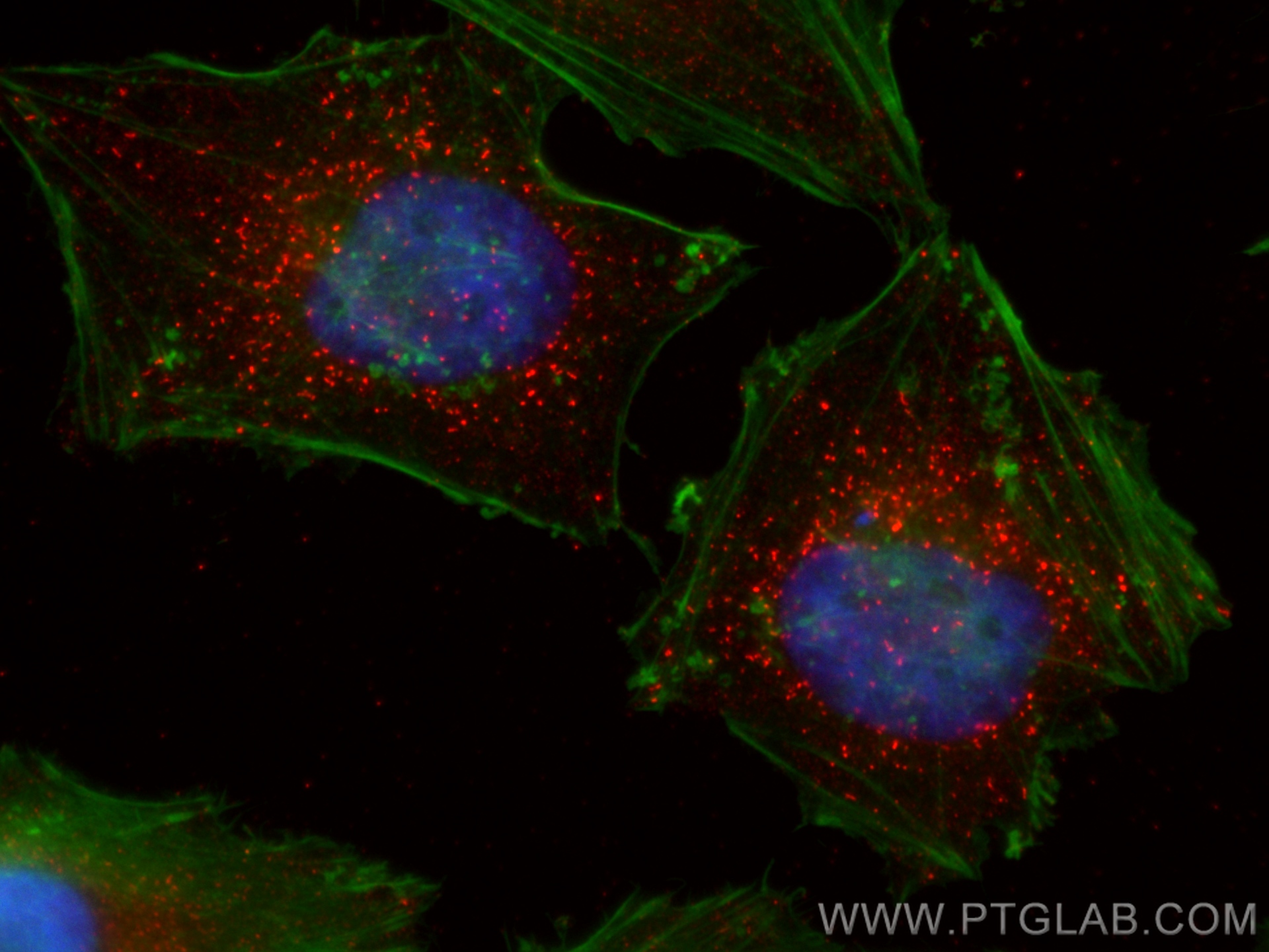 IF Staining of HeLa using CL594-80234