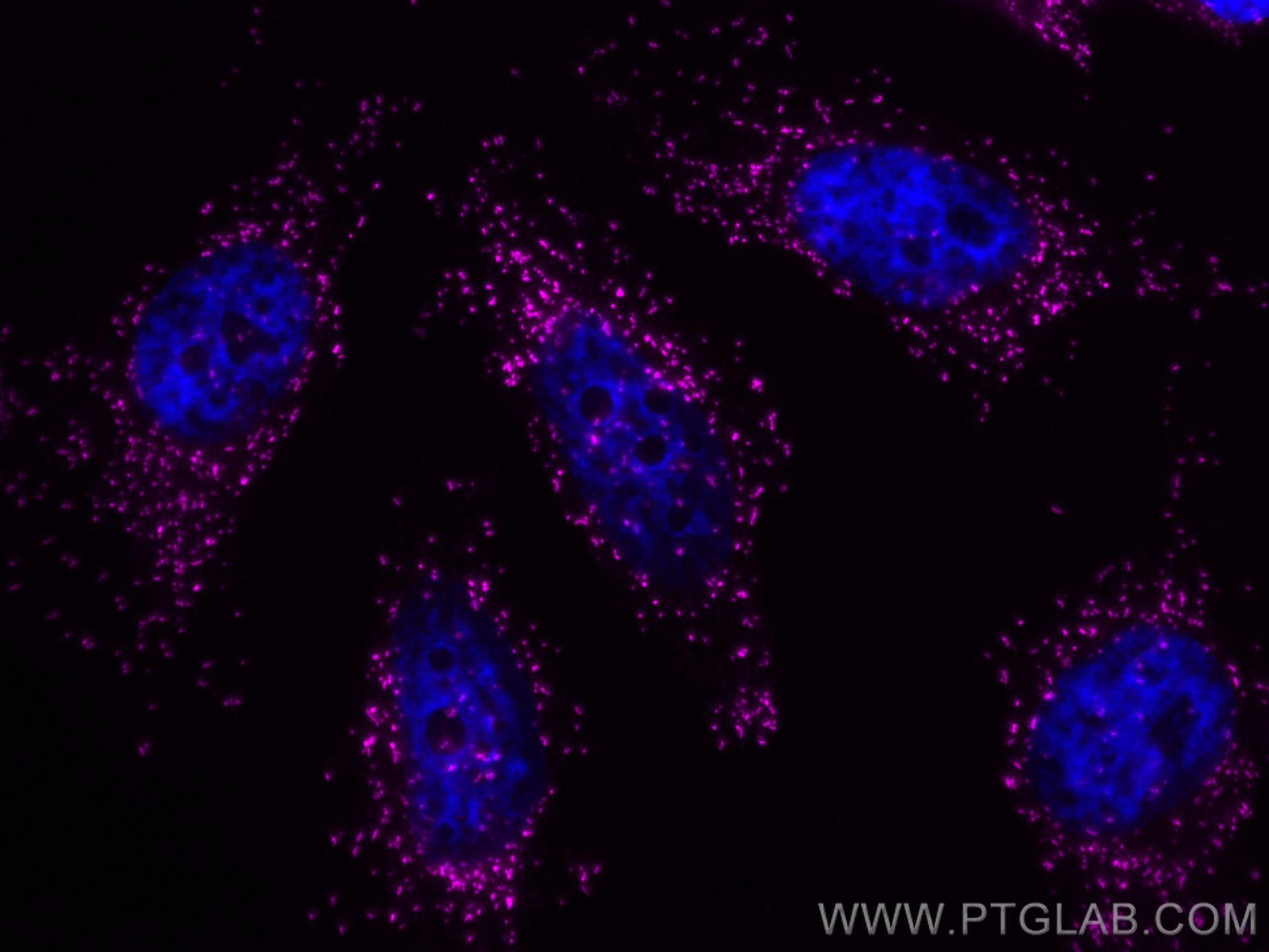 IF Staining of HeLa using CL647-10594