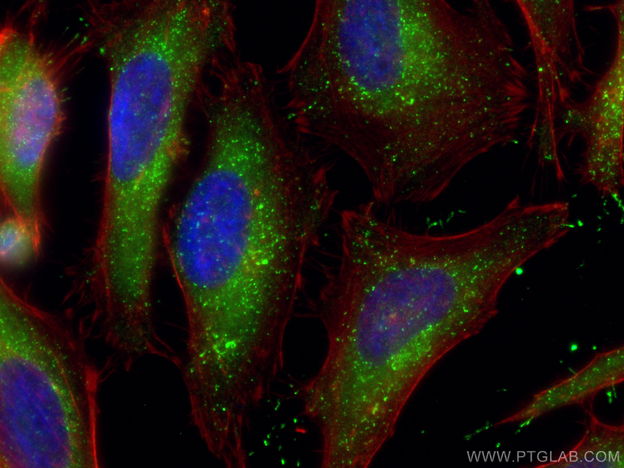 IF Staining of HeLa using 80196-1-RR (same clone as 80196-1-PBS)