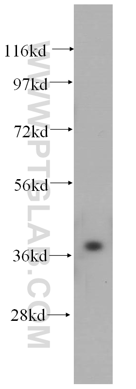 WB analysis of human liver using 14816-1-AP