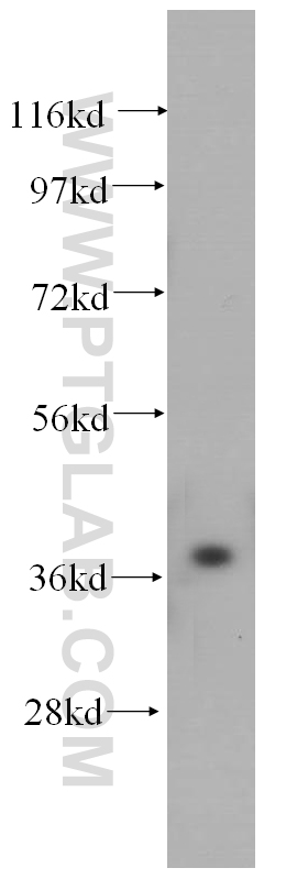 WB analysis of human liver using 14816-1-AP