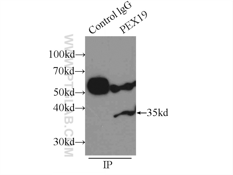 IP experiment of K-562 using 14713-1-AP