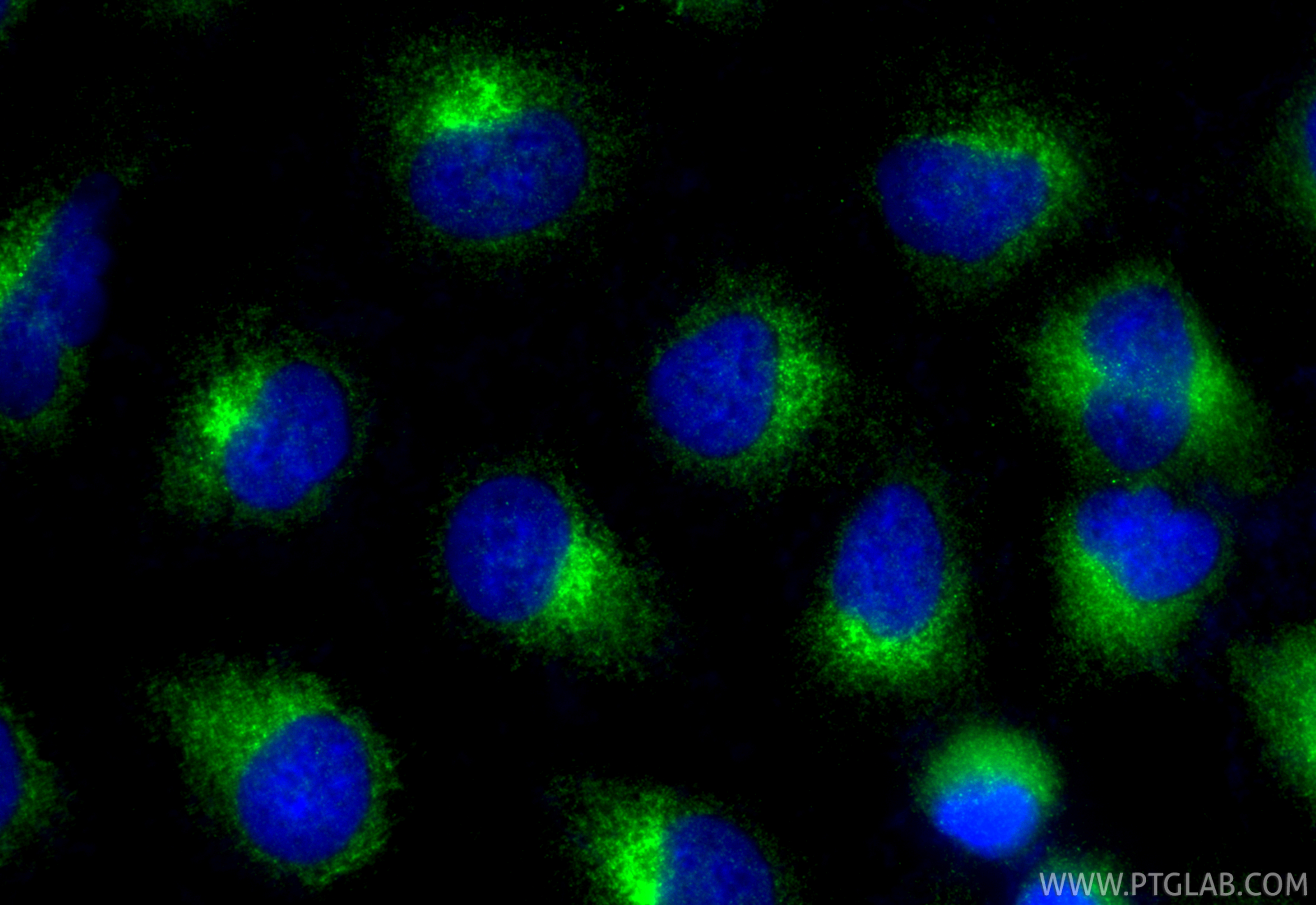 IF Staining of A549 using 12545-1-AP