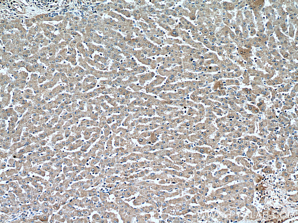 IHC staining of human liver using 66309-1-Ig (same clone as 66309-1-PBS)