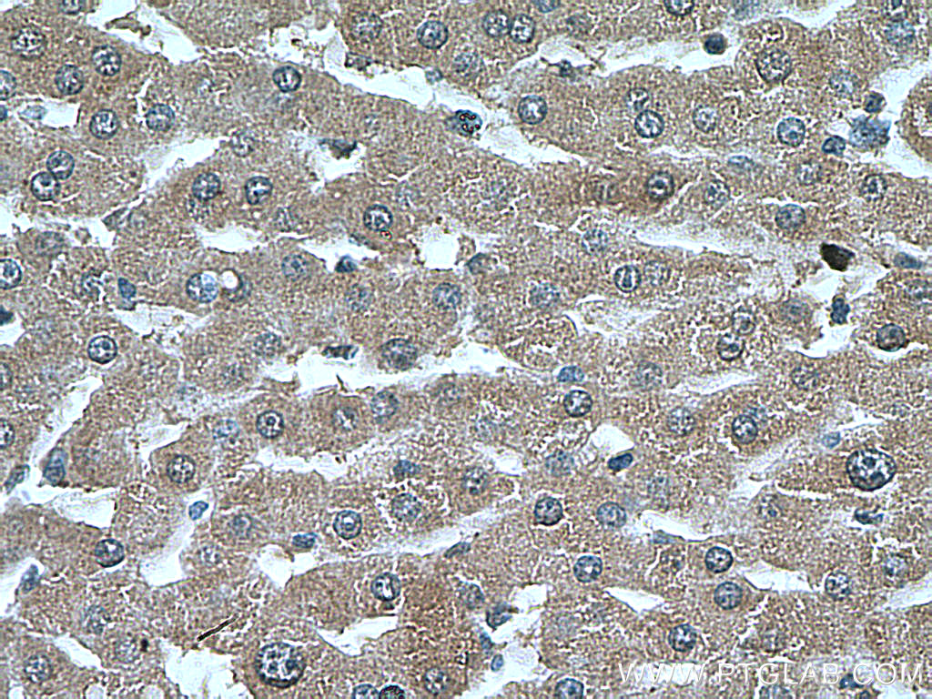 IHC staining of human liver using 66309-1-Ig (same clone as 66309-1-PBS)
