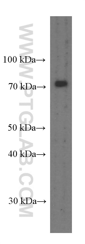 WB analysis of pig brain using 66309-1-Ig (same clone as 66309-1-PBS)