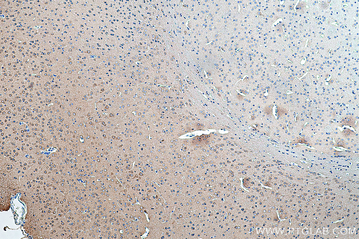 IHC staining of mouse brain using 13084-1-AP