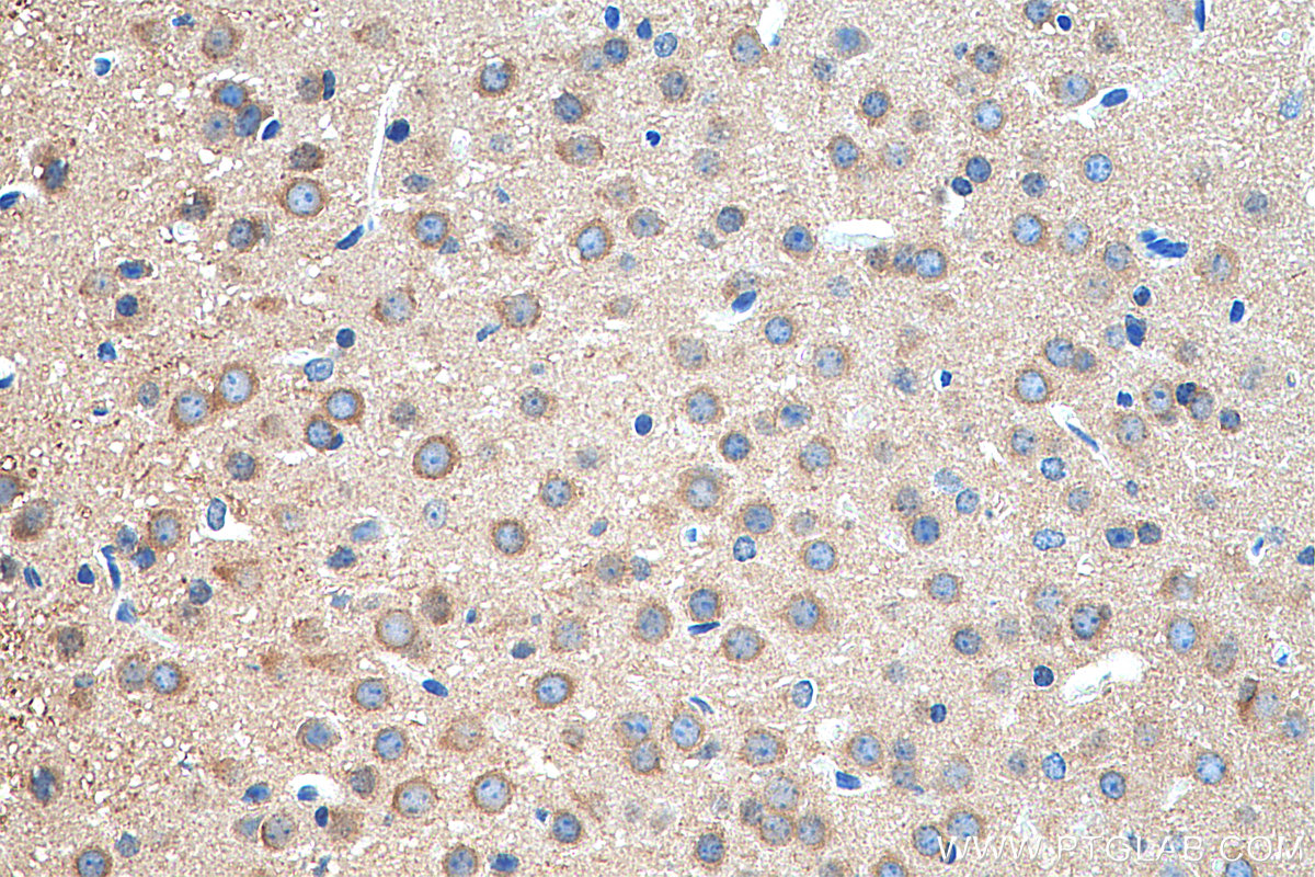 IHC staining of mouse brain using 13084-1-AP