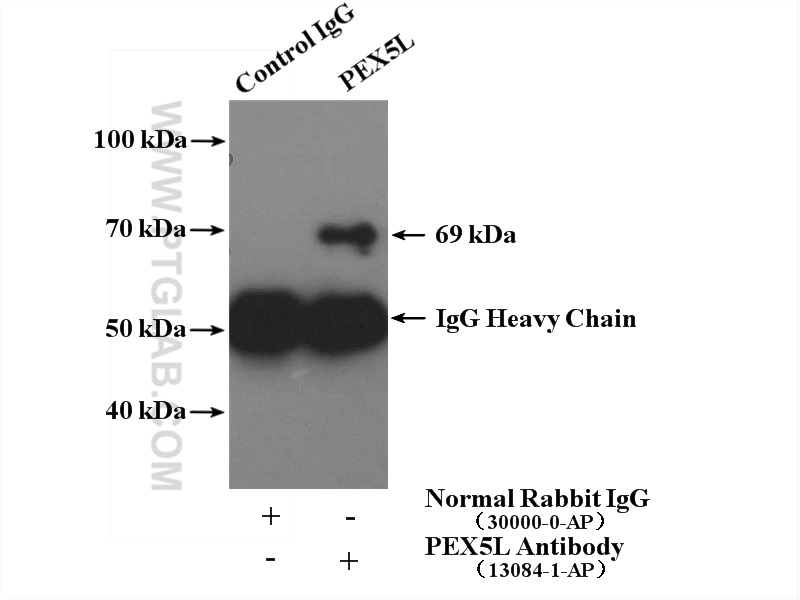 IP experiment of mouse brain using 13084-1-AP