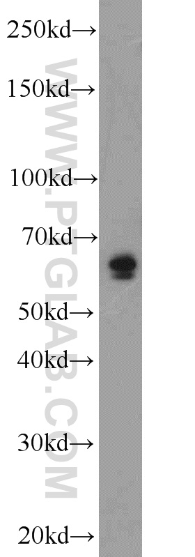 WB analysis of mouse brain using 13084-1-AP